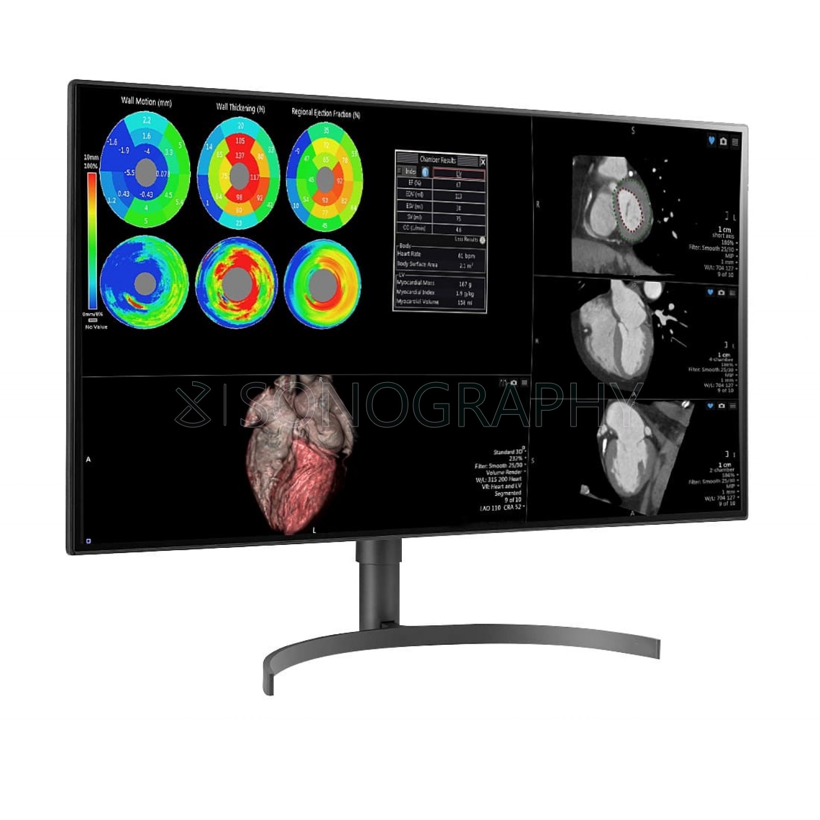 Double Black Imaging 60' Professional LCD