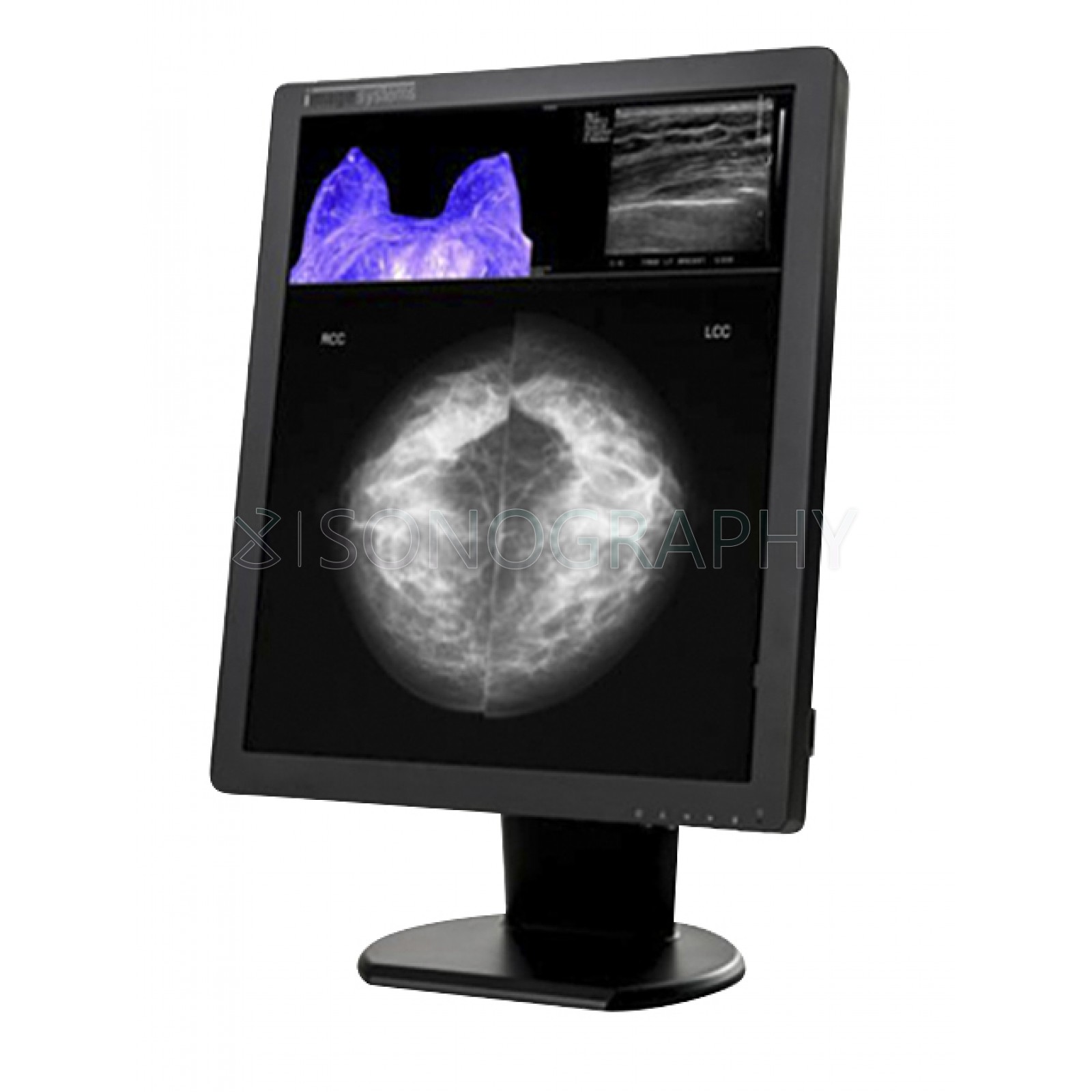 Double Black Imaging 5MP Color Diagnostic Display (C5MPN)