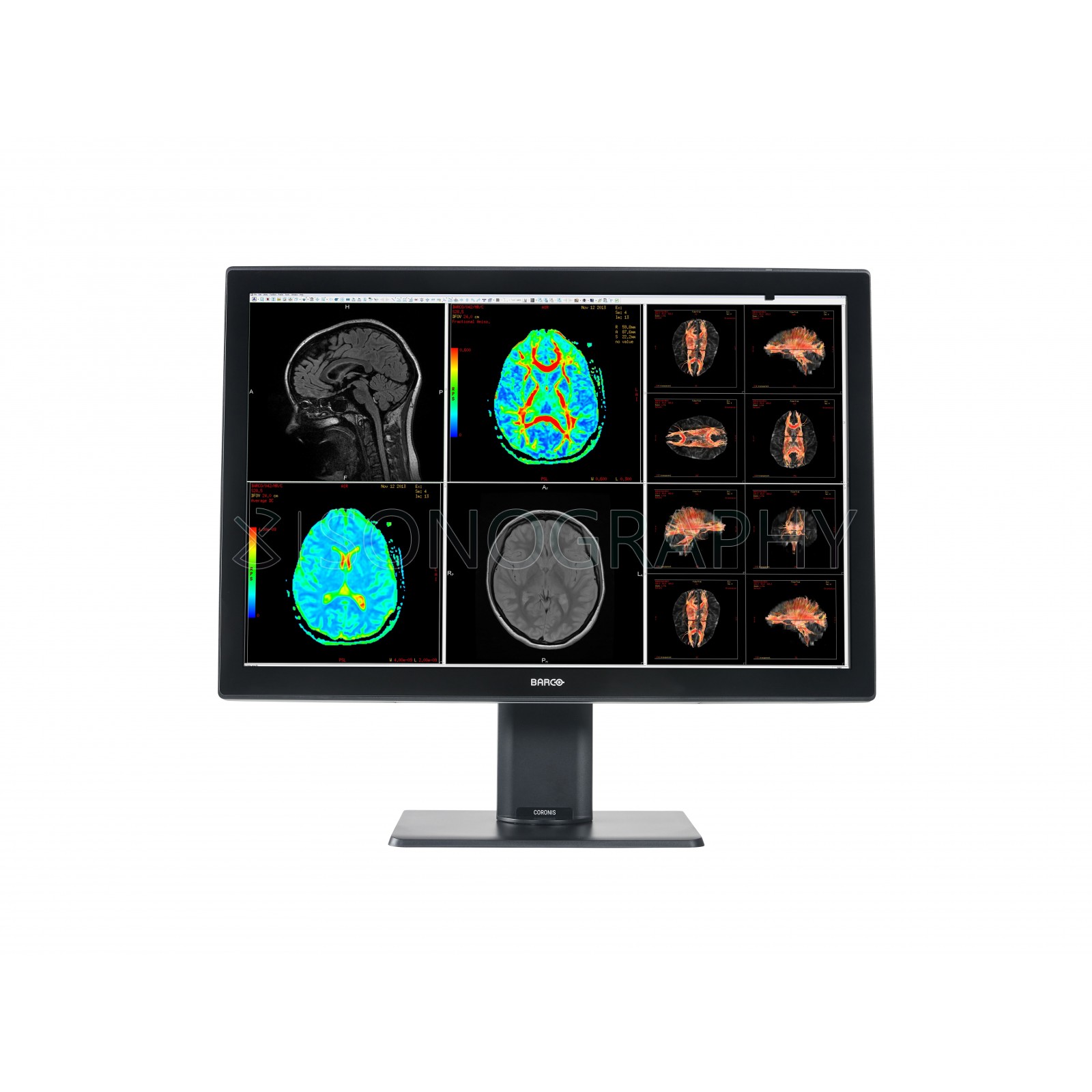 Barco Coronis Fusion 4MP MDCC-4430