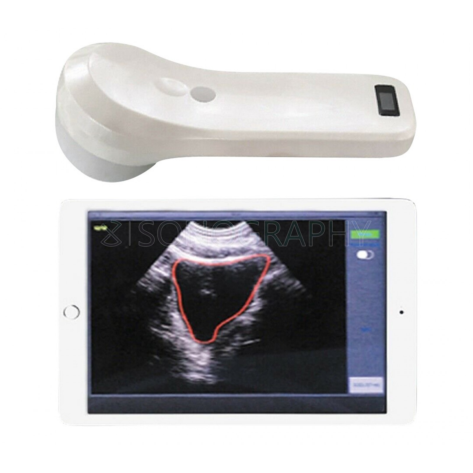 SonoStar BProbe-2 SonoStar BProbe-2