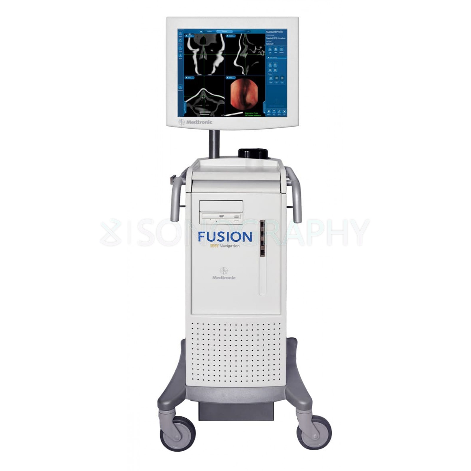 Medtronic Fusion ENT Medtronic Fusion ENT