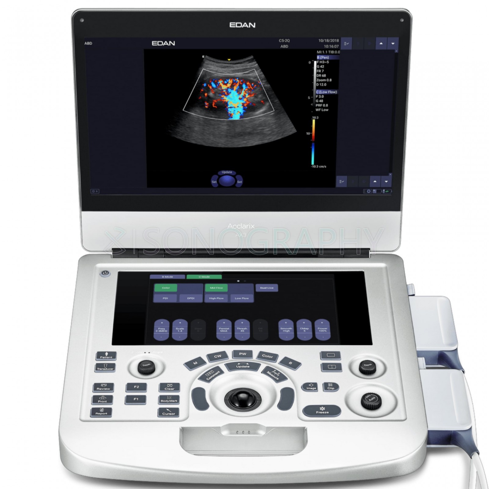 Edan Acclarix AX3 Edan Acclarix AX3