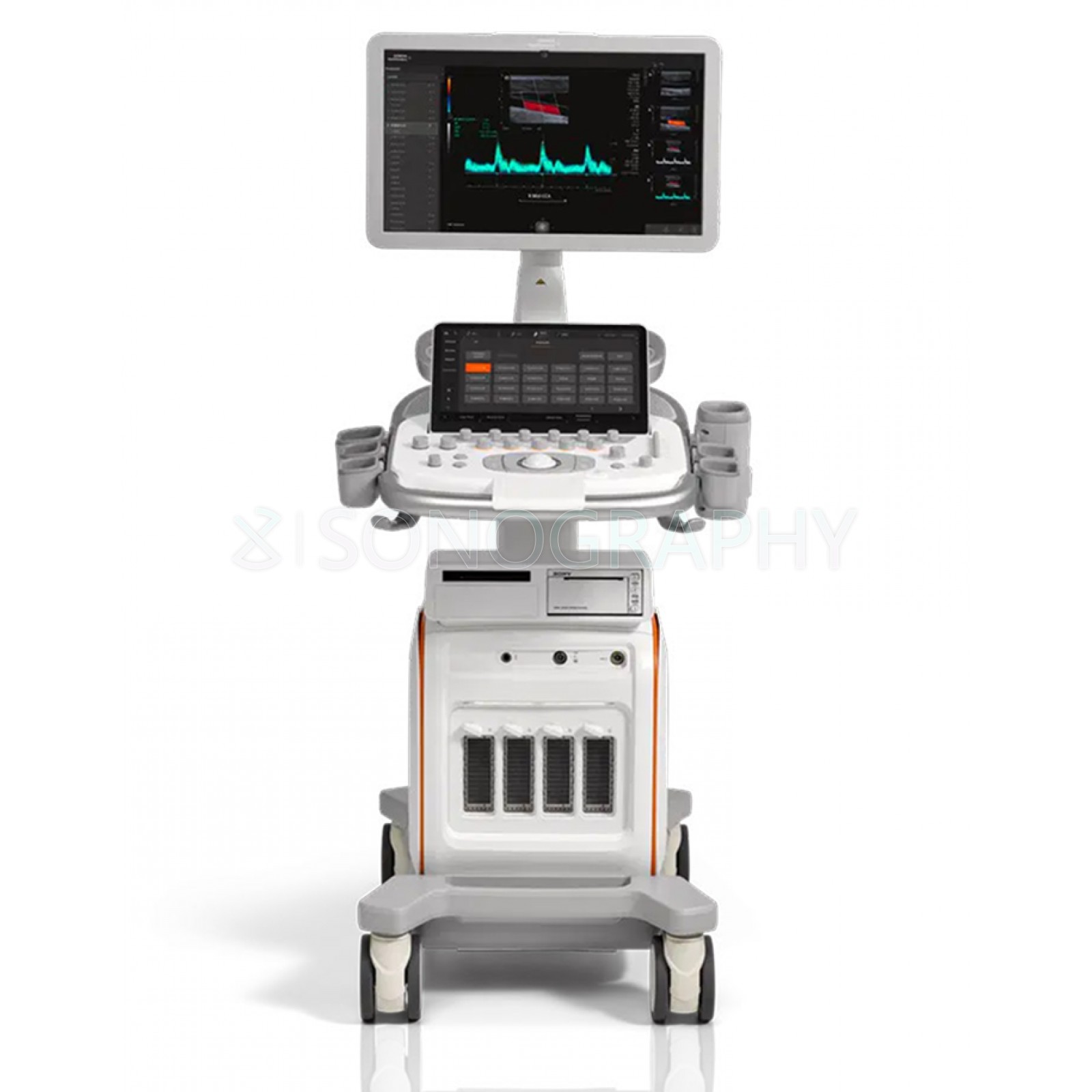 Siemens Acuson Redwood