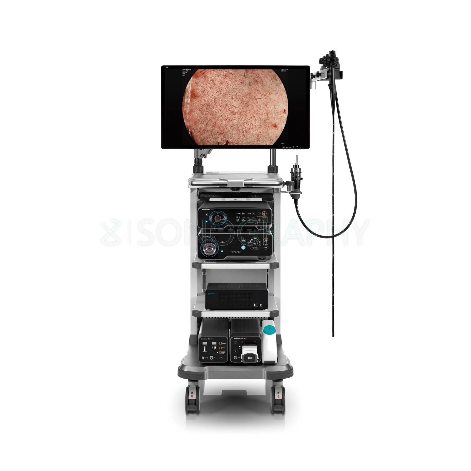 Sonoscape HD-650