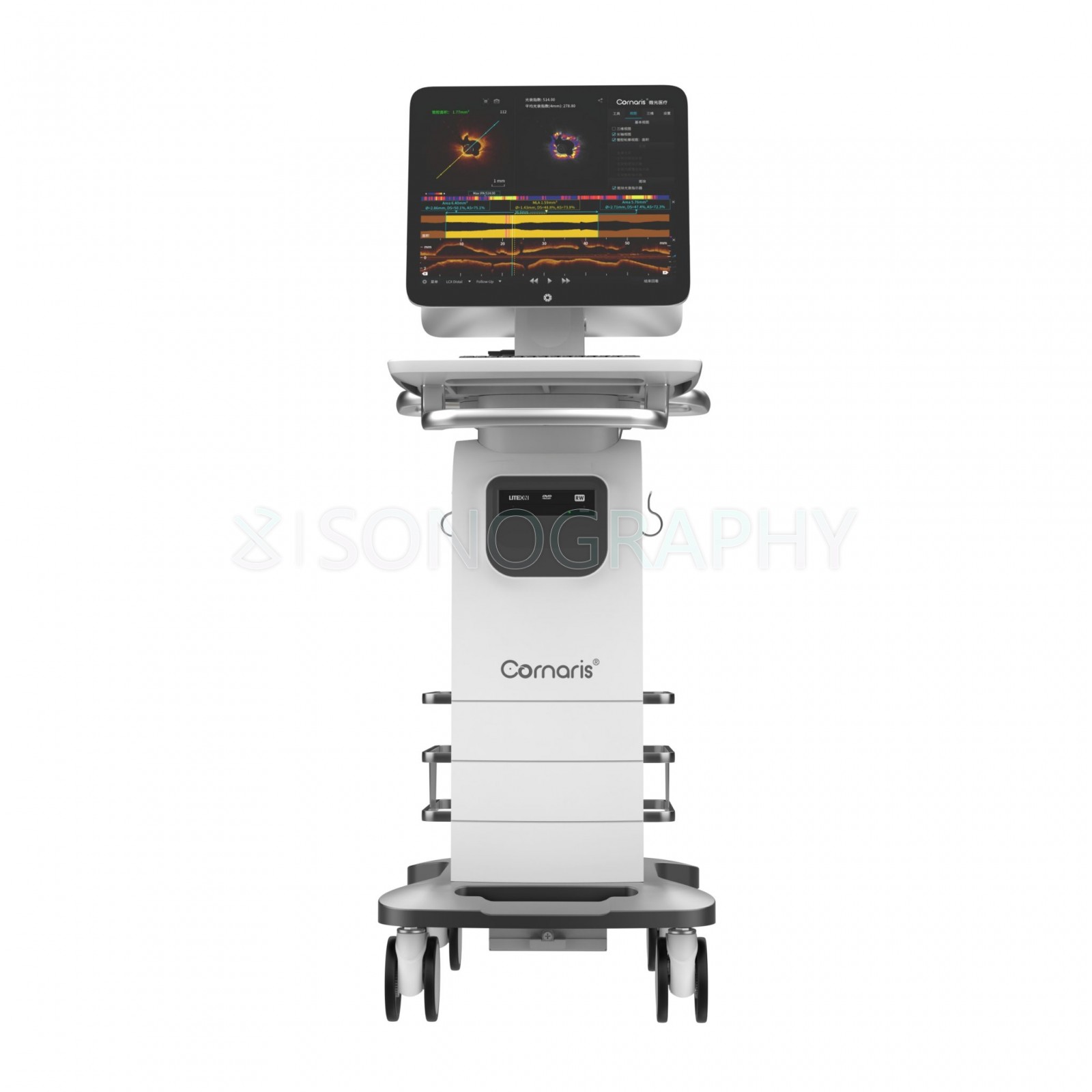 Vivolight Cornaris P80