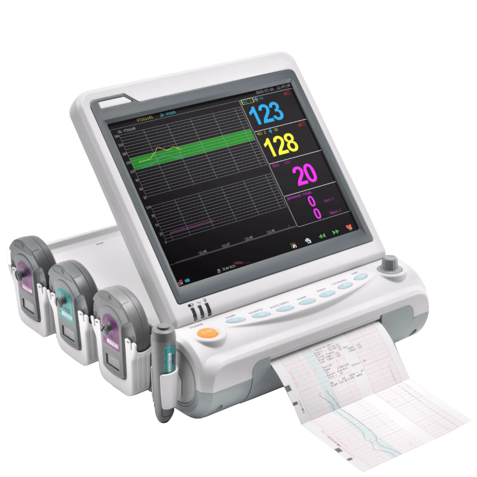 Фетальные мониторы купить с доставкой по Москве. Сравнение цен по каталогу.  Компания Сонографи.